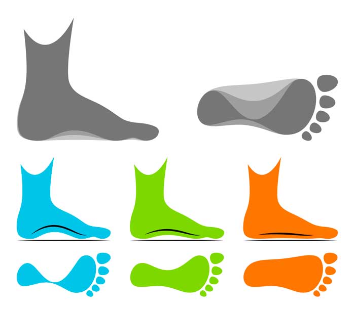 Diferencias y similitudes entre el pie cavo y el pie plano