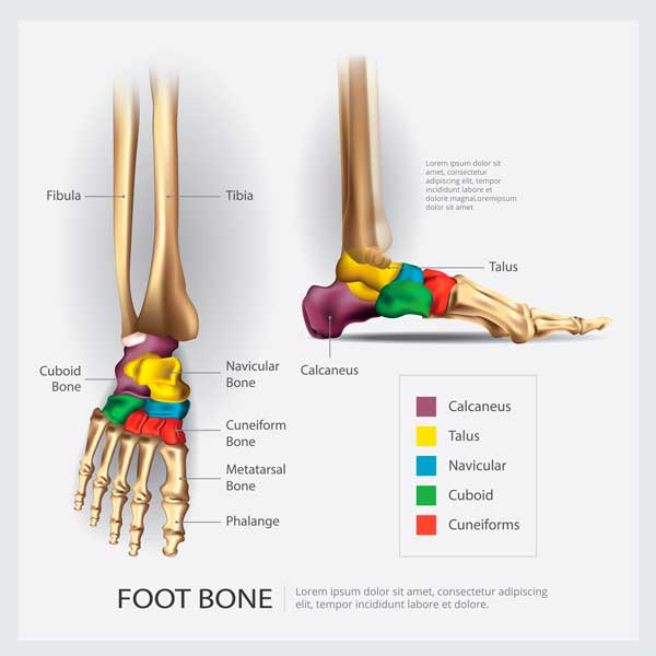 ¿Se cura la necrosis ósea de los huesos de los pies?